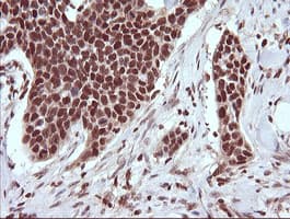 TRIM38 Antibody (clone OTI113D3)