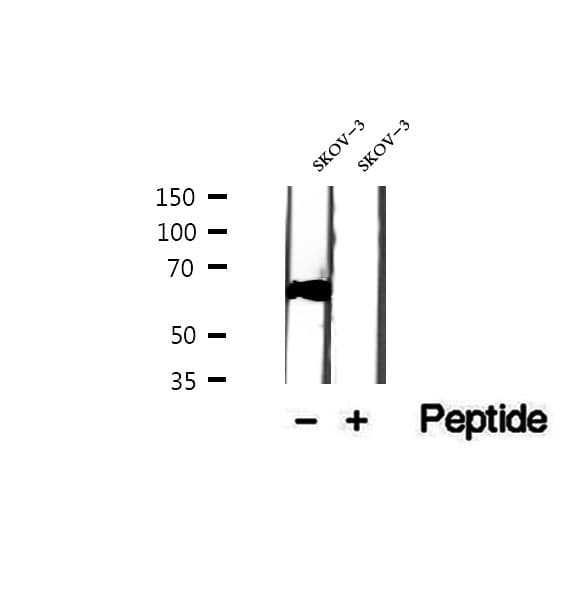 Polyclonal Rabbit anti-Human E2F3 Antibody (IHC, WB)