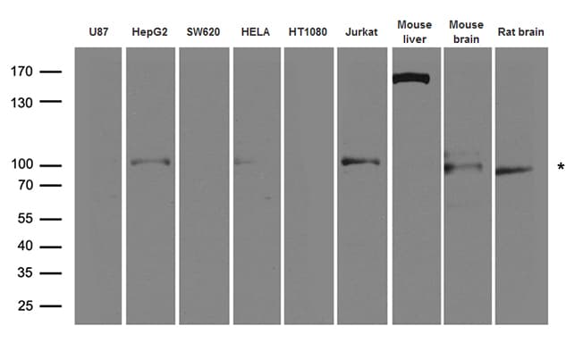 Polyclonal Rabbit anti-Human BRAF / B-Raf Antibody (WB)