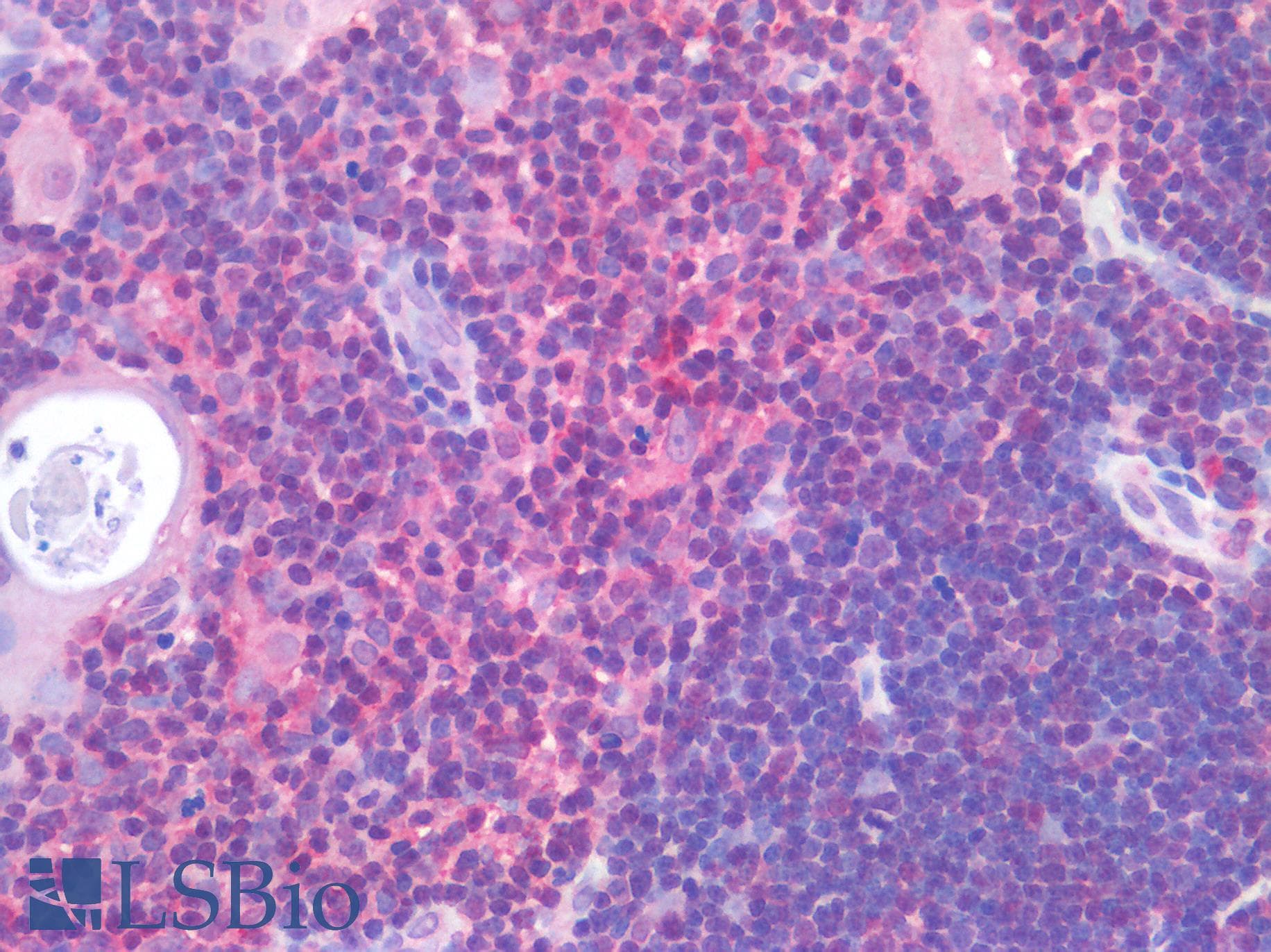 IHC-plus™ AML1 / RUNX1 Antibody