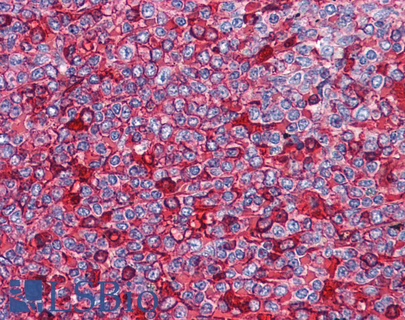 IHC-plus™ NFAT1 / NFATC2 Antibody (aa729-743)