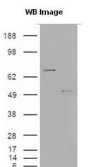 Polyclonal Rabbit anti-Human S100A9 / MRP14 Antibody (IF, WB)