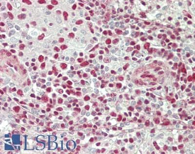 IHC-plus™ XRN2 Antibody (aa900-950)
