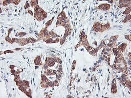 PFDN6 / HKE2 Antibody (clone OTI4E10)