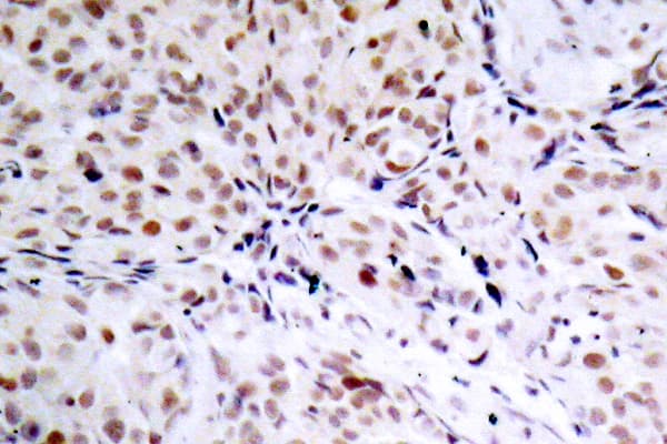 RB1 / Retinoblastoma / RB Antibody (phospho-Ser795)