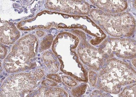 GSK3A / GSK3 Alpha Antibody (phospho-Tyr279,pTyr216)