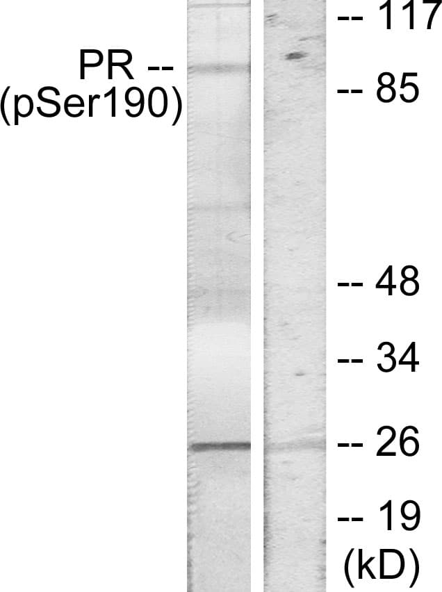 PR / Progesterone Receptor Antibody (phospho-Ser190)