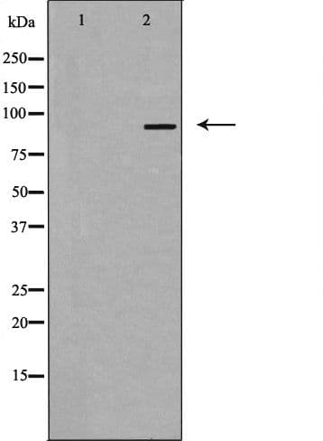 Polyclonal Rabbit anti-Human RBM5 / G15 Antibody (IHC, IF, WB)