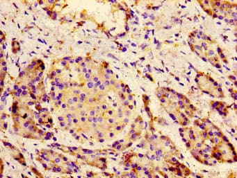 CACNA1C / Cav1.2 Antibody