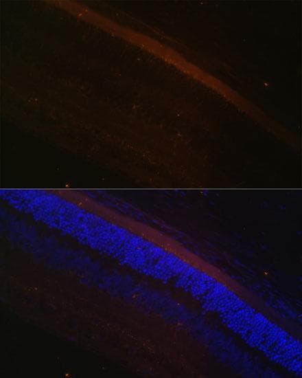 Rhodopsin Kinase / GRK1 Antibody