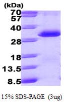 Human PSME1 Protein (Recombinant His)