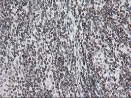 CRY2 Antibody (clone OTI1H5)