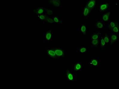 Polyclonal Rabbit anti-Human HIST1H3A Antibody (IHC, IF, WB)