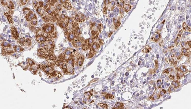 Polyclonal Rabbit anti-Human SCN2A / Nav1.2 Antibody (IHC, WB)