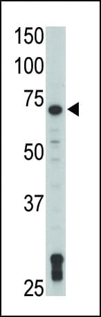 TXK / RLK Antibody (aa22-52)