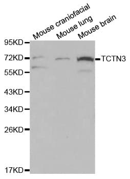 Polyclonal Rabbit anti-Human TCTN3 Antibody (IHC, WB)