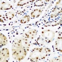 TCEB1 / Elongin C Antibody