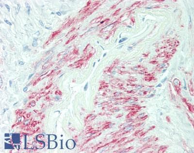 IHC-plus™ Polyclonal Rabbit anti-Human FER Antibody (IHC, WB)