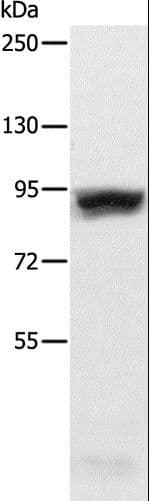 R1 / RRM1 Antibody