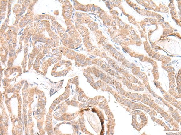 Polyclonal Rabbit anti-Human PLGLB2 / PLGLB1 Antibody (IHC)