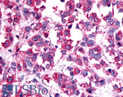 PathPlus™ GCGR / Glucagon Receptor Antibody (Extracellular Domain)