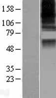 CASD1 Protein (Over-Expression Lysate Myc-DDK (Flag))