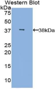 MBL2 / Mannose Binding Protein Antibody (aa42-96)