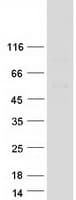 Human EOGT Protein (Recombinant Myc-DDK (Flag))