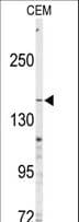 ABCC4 / MRP4 Antibody (aa1117-1145)