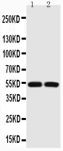 Polyclonal Rabbit anti-Human TP53 / p53 Antibody (aa74-393, IHC, WB)