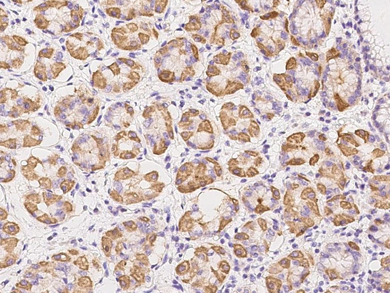 TCTN3 Antibody