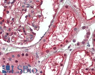 TMEM27 / Collectrin Antibody
