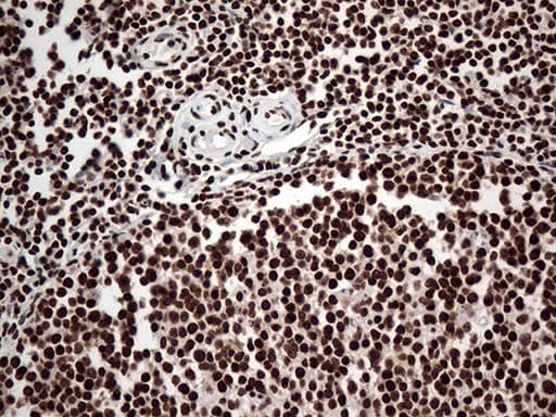 Monoclonal Mouse anti-Human KARS Antibody (clone OTI1E7, IHC, WB)