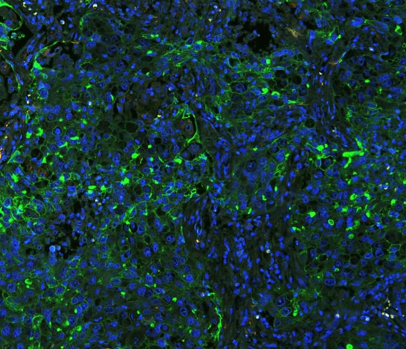 ICAM-1 / CD54 Antibody (aa214-532)
