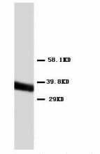 IHC-plus™ ANXA5 / Annexin V Antibody (C-Terminus)