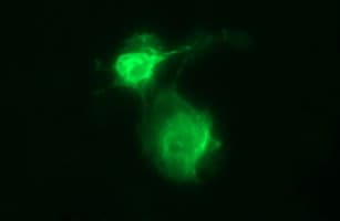 UPRT Antibody (clone OTI1E11)