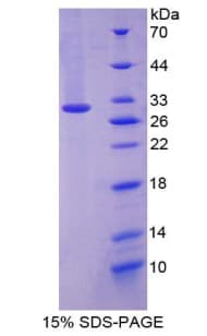 Mouse PXN / Paxillin Protein (Recombinant His-T7)