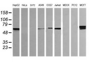 IHC-plus™ Monoclonal Mouse anti-Human DIXDC1 Antibody (clone 6B6, IHC, IF, WB)