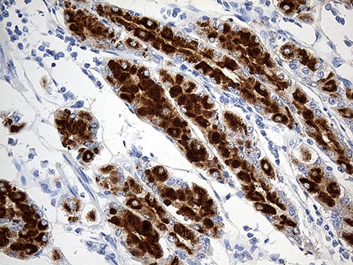 Monoclonal Mouse anti-Human TFF1 / pS2 Antibody (clone OTI1A4, aa25-84, IHC, WB)