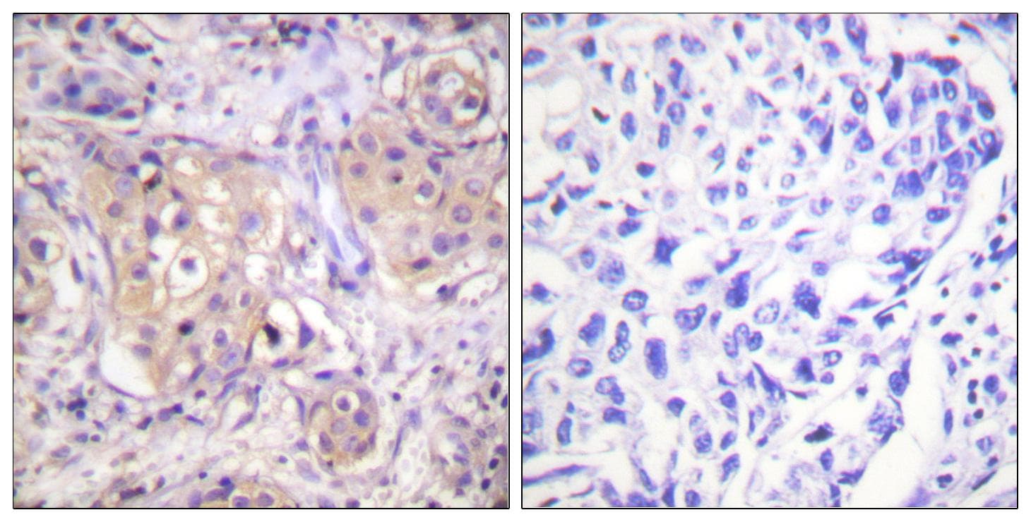 PKC / Protein Kinase C Antibody (phospho-Thr497)