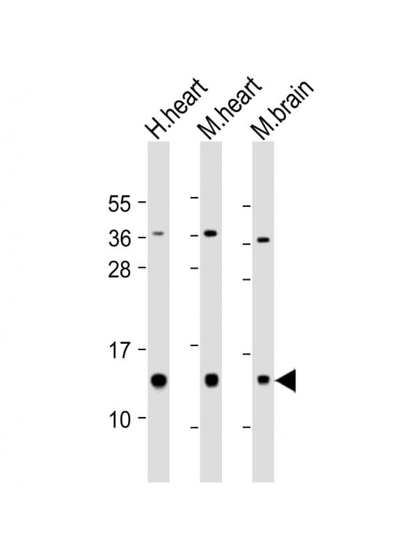 Polyclonal Rabbit anti-Human NDUFB3 Antibody (aa14-49, WB)