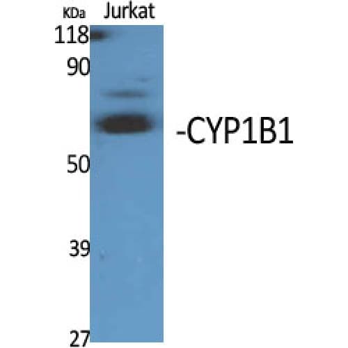 Polyclonal Rabbit anti-Human CYP1B1 Antibody (Internal, WB)