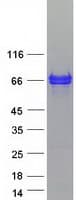 Human MACROD2 Protein (Recombinant Myc-DDK (Flag))