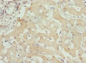 ITPK1 Antibody