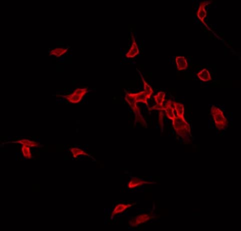 MAP3K5 / ASK1 Antibody (phospho-Ser966)