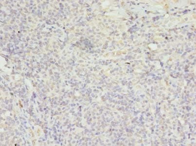 Polyclonal Rabbit anti-Human FPR1 / FPR Antibody (IHC, WB)