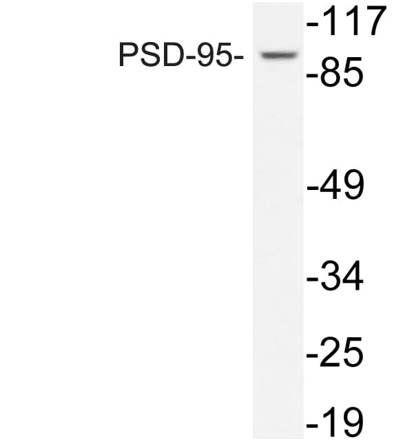 Polyclonal Rabbit anti-Human DLG4 / PSD95 Antibody (Leu302, WB)