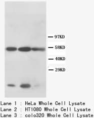 KRT8 / CK8 / Cytokeratin 8 Antibody (N-Terminus)