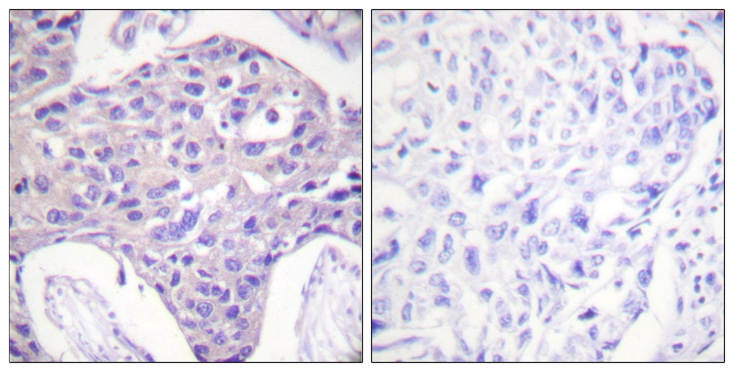 Polyclonal Rabbit anti-Human FOXO1+3+4 Antibody (Ab-24/32, IHC)