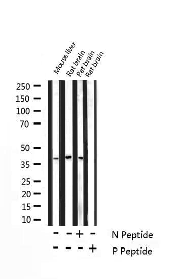 PPP1R1B / DARPP-32 Antibody (phospho-Thr75)